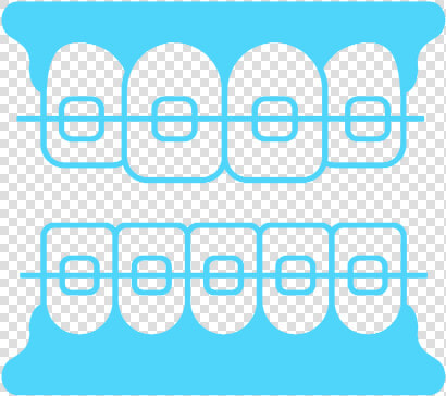 Burns Orthodontics Clear Braces For Straight Teeth   Graphics  HD Png DownloadTransparent PNG