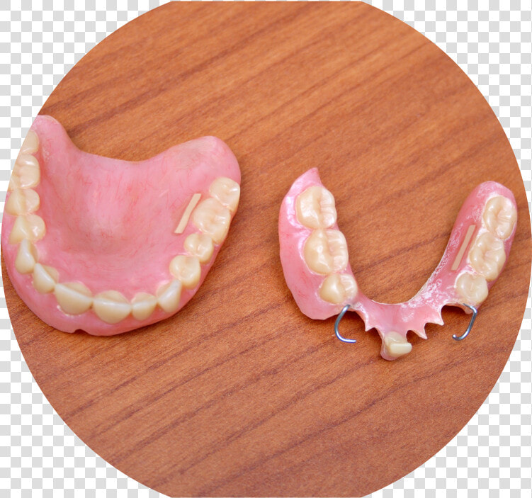 Dentures   Részleges Protézis  HD Png DownloadTransparent PNG