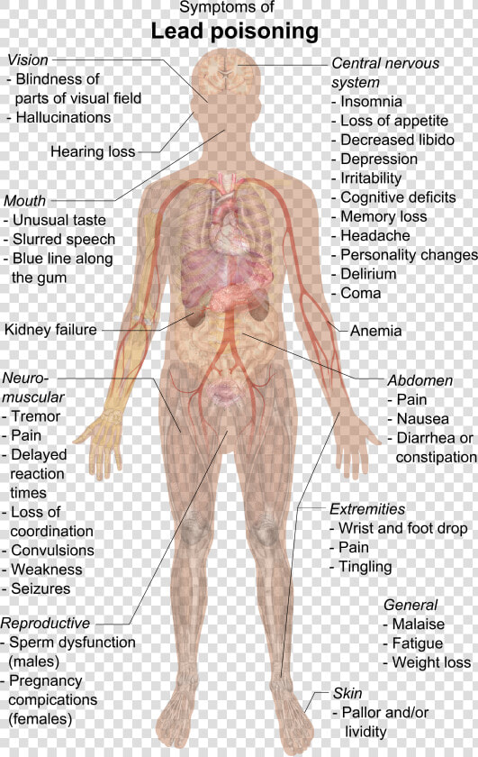 Symptoms Of Lead Poisoning   Lead Poisoning Symptoms  HD Png DownloadTransparent PNG