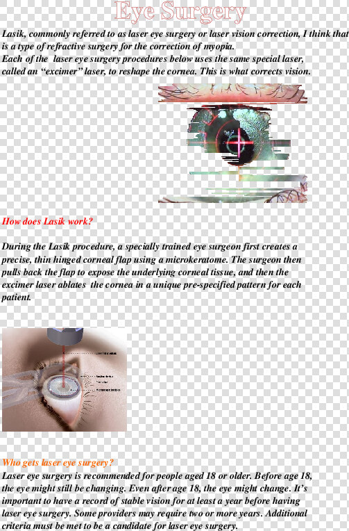 Laser Eye Surgery  HD Png DownloadTransparent PNG