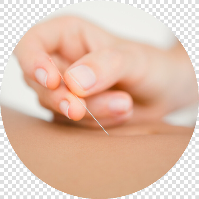 Acupuncture   Acupuncture Transparent  HD Png DownloadTransparent PNG