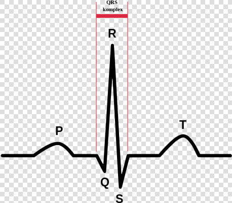 Normal Sinus Rhythm  HD Png DownloadTransparent PNG