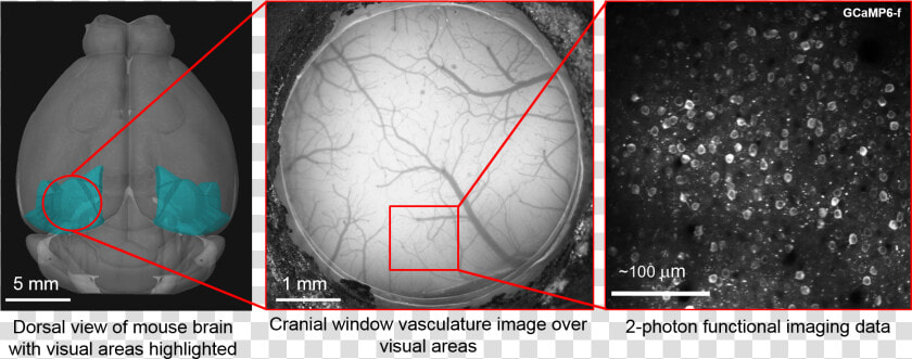 Png File Surgery   Visual Cortex Mouse Brain Cranial  Transparent PngTransparent PNG