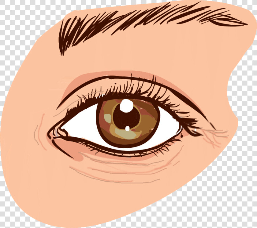 Eye wrinkles   Causes Dark Circles Eye  HD Png DownloadTransparent PNG