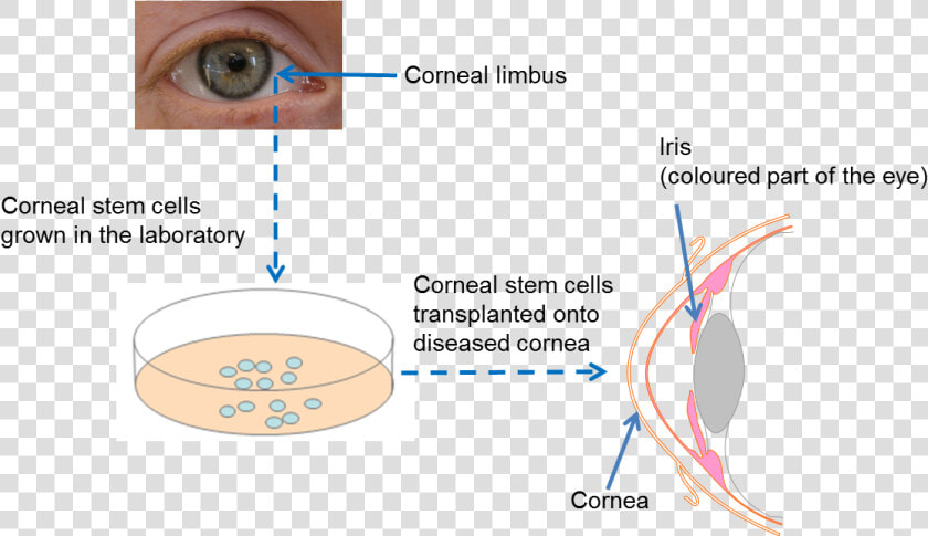 Diagram On Repairing The Cornea   Holoclar Stem Cell  HD Png DownloadTransparent PNG