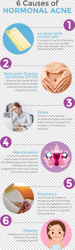 6 Causes Of Hormonal Acne Infographic   Androgen Acne  HD Png DownloadTransparent PNG