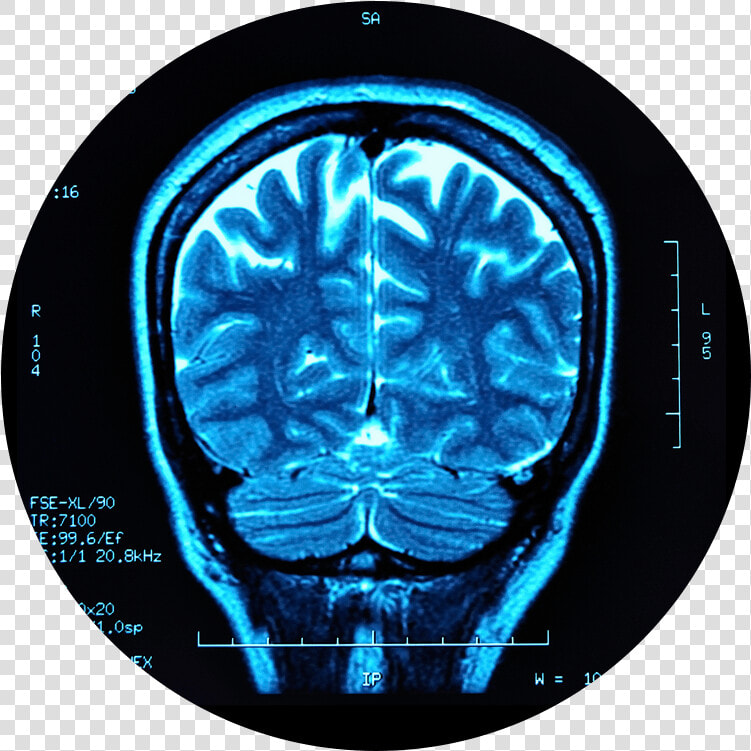 Traumatic Brain Injury   Png Download  Transparent PngTransparent PNG