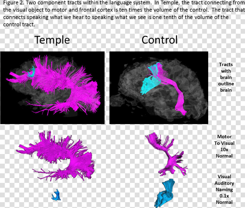 Brain Outline Png   Png Download   Asperger Syndrome Brain Scan  Transparent PngTransparent PNG