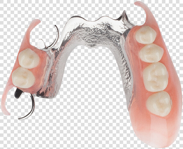 Single Dental Implant 1   Dentistry  HD Png DownloadTransparent PNG