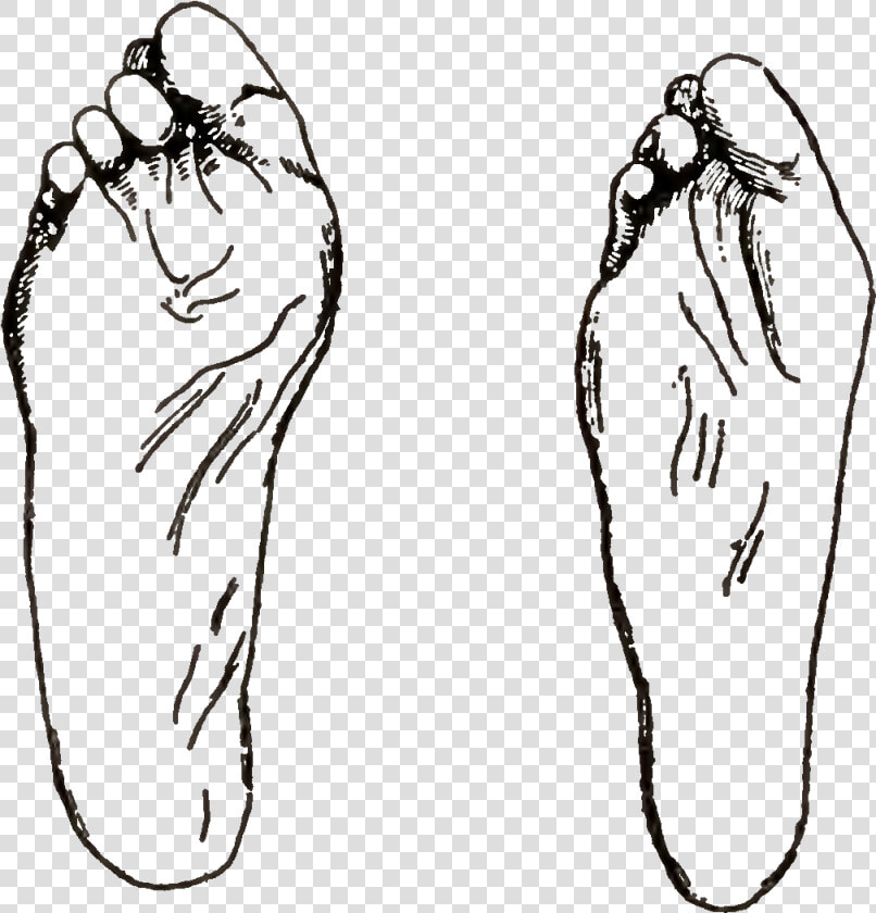 Fig46 Deformities Of Feet Resulting From Bad Shoes  HD Png DownloadTransparent PNG