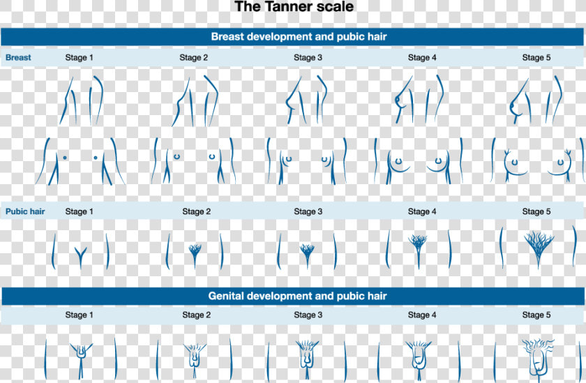 This Picture Depicts The Stages Of Pubic Hair  Genital    Tanner Scale Pubic Hair  HD Png DownloadTransparent PNG