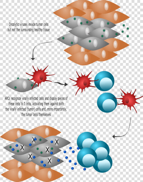 Transparent Malignant Clipart  HD Png DownloadTransparent PNG