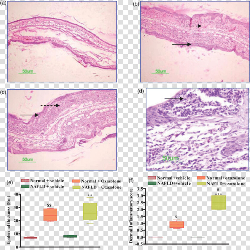 Transparent Mouse Ears Png   Mouse Ear Histology  Png DownloadTransparent PNG