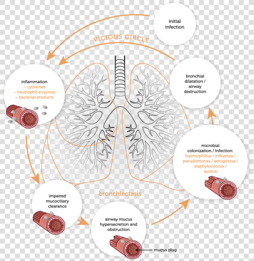 Physiology   Vicious Cycle   Vicious Cycle Of Bronchiectasis  HD Png DownloadTransparent PNG