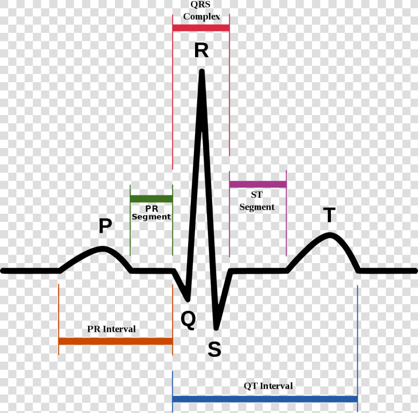 P Qrs T Ecg  HD Png DownloadTransparent PNG