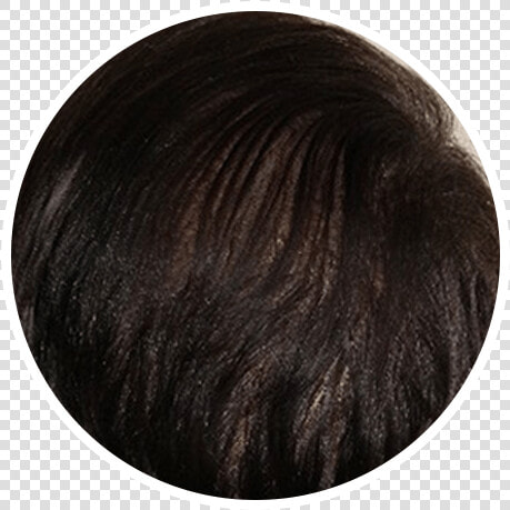 After Hair Restoration In A Circular Picture   Blond  HD Png DownloadTransparent PNG