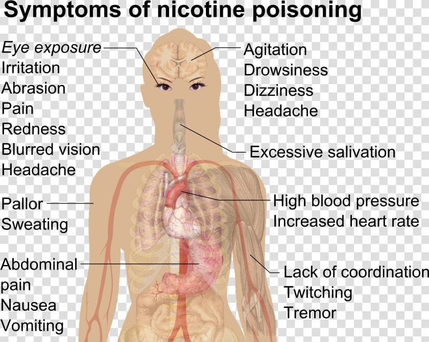 Symptoms Of Nicotine Poisoning   Nicotine Poisoning  HD Png DownloadTransparent PNG