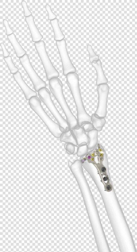 Transparent Bone Radius   Placa Acu Loc 2  HD Png DownloadTransparent PNG