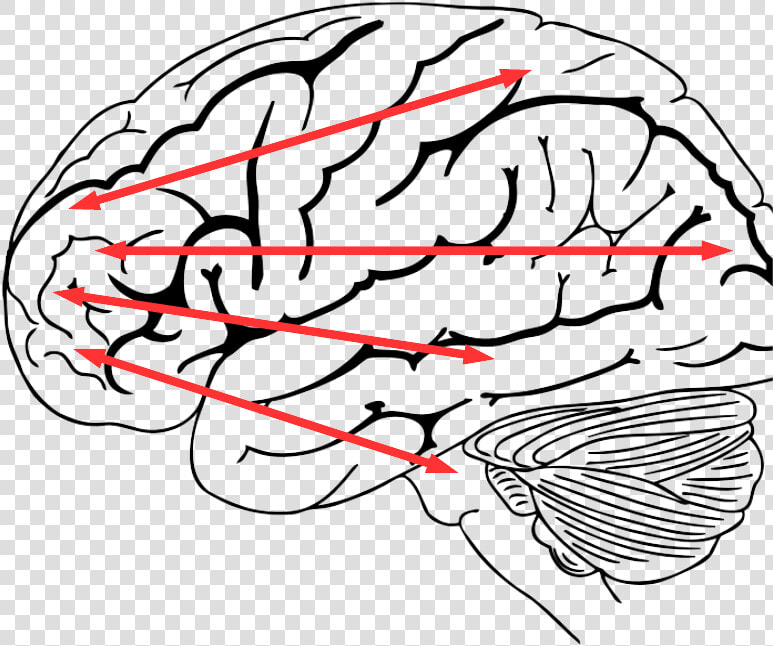 Brain On Lack Of Sleep  HD Png DownloadTransparent PNG