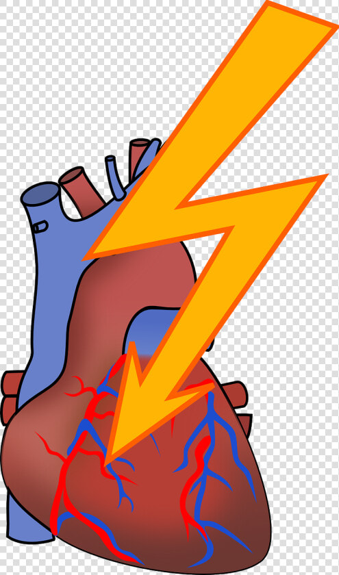 Heart Attack Reason In Urdu  HD Png DownloadTransparent PNG