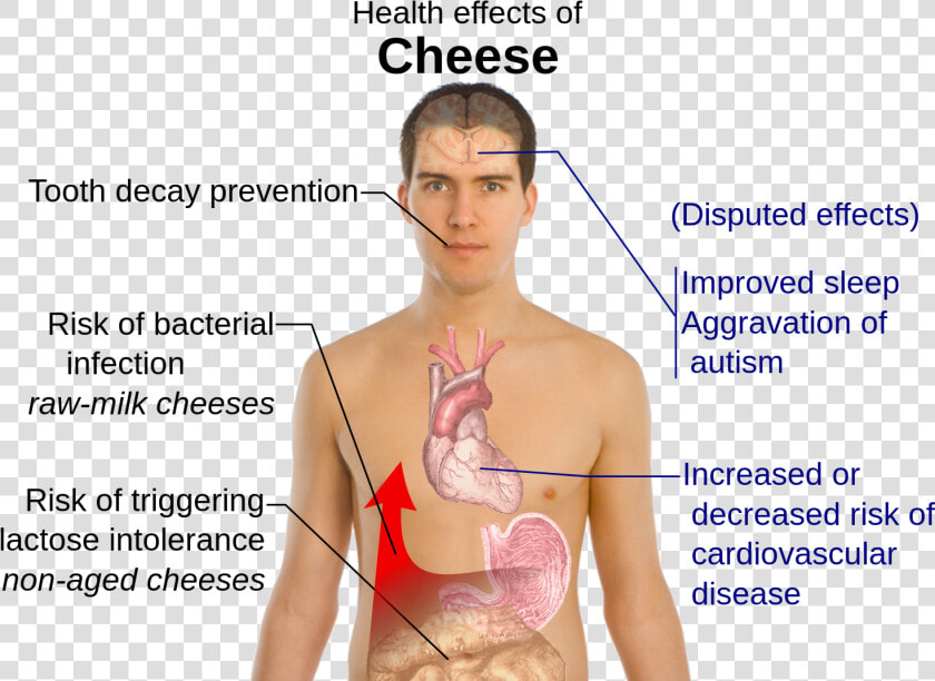 Lactose Intolerance Effects  HD Png DownloadTransparent PNG