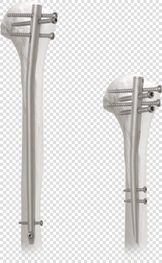 With A Proximal Bend Of 6 Degrees  The Aos Short Nail   Humerus Intramedullary Nail  HD Png DownloadTransparent PNG