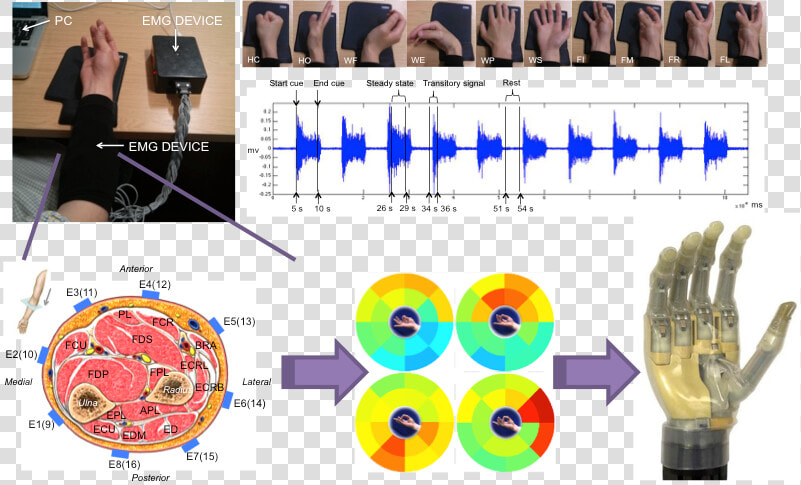 Emg hand   Limb Hand  HD Png DownloadTransparent PNG