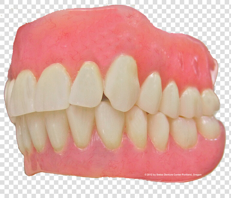 Custom Made Denture   Tongue  HD Png DownloadTransparent PNG