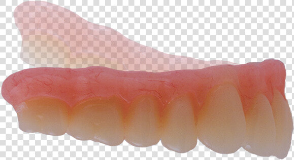 Good Fit Instant Denture Setups   Tongue  HD Png DownloadTransparent PNG