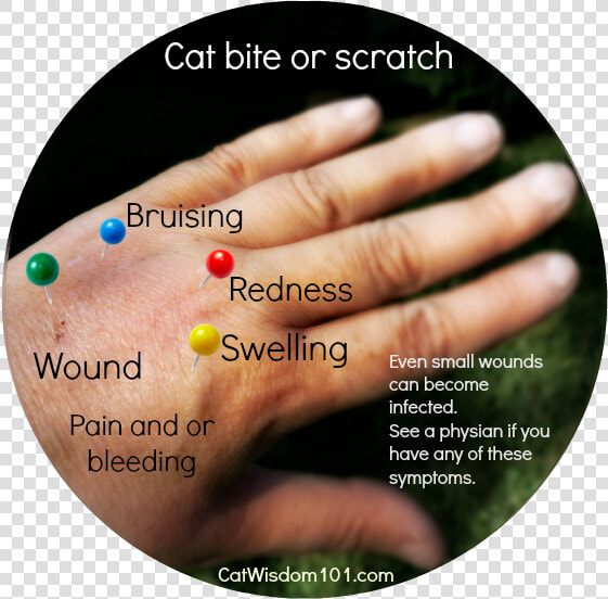 Cat Bite scratch Pasteurella   Cat Bite Vs Scratch  HD Png DownloadTransparent PNG