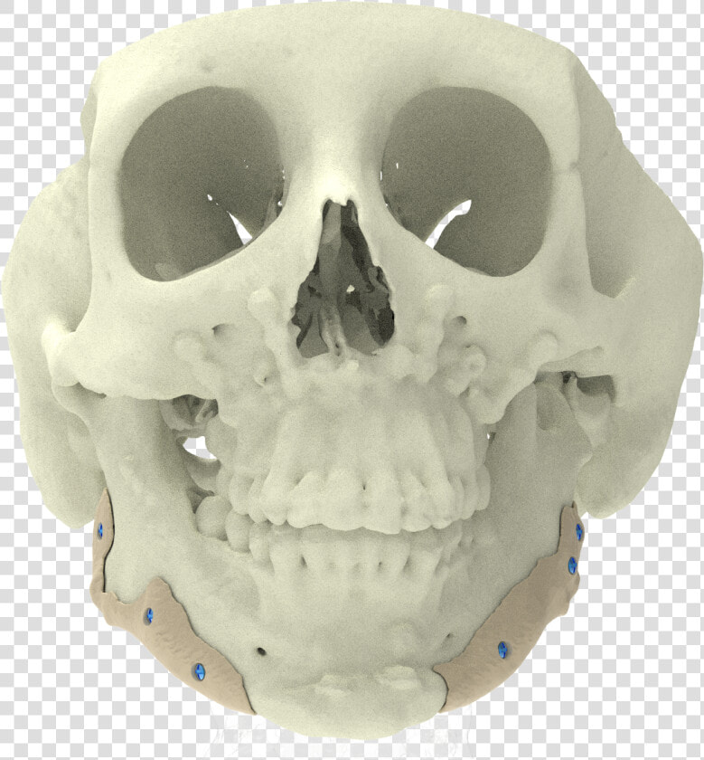 Xilloc Medical B   Skull  HD Png DownloadTransparent PNG