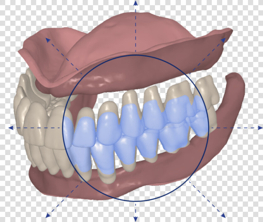 Signatureteeth   Signature Digital Dentures  HD Png DownloadTransparent PNG