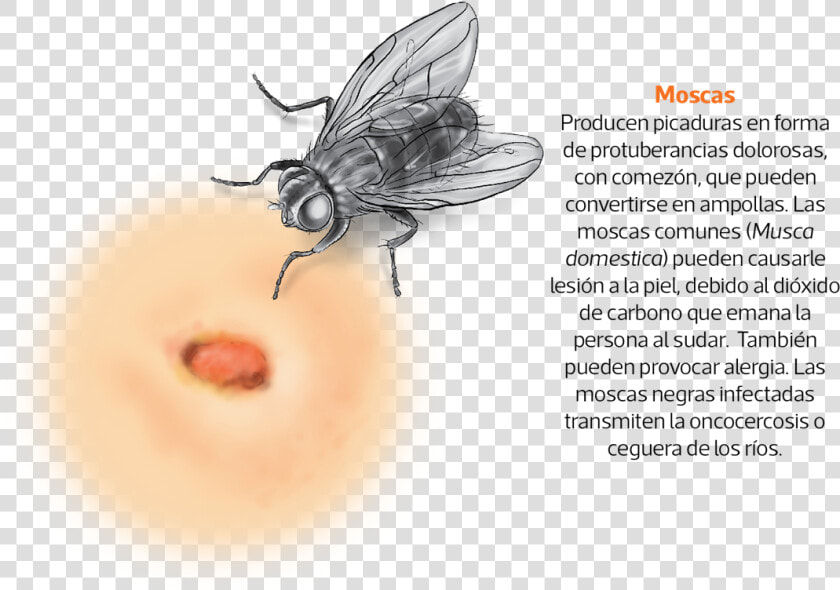 Picadura La Mosca Negra  HD Png DownloadTransparent PNG