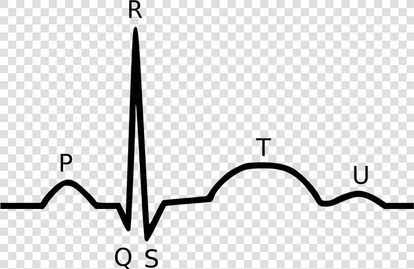 Qrs Complex  HD Png DownloadTransparent PNG