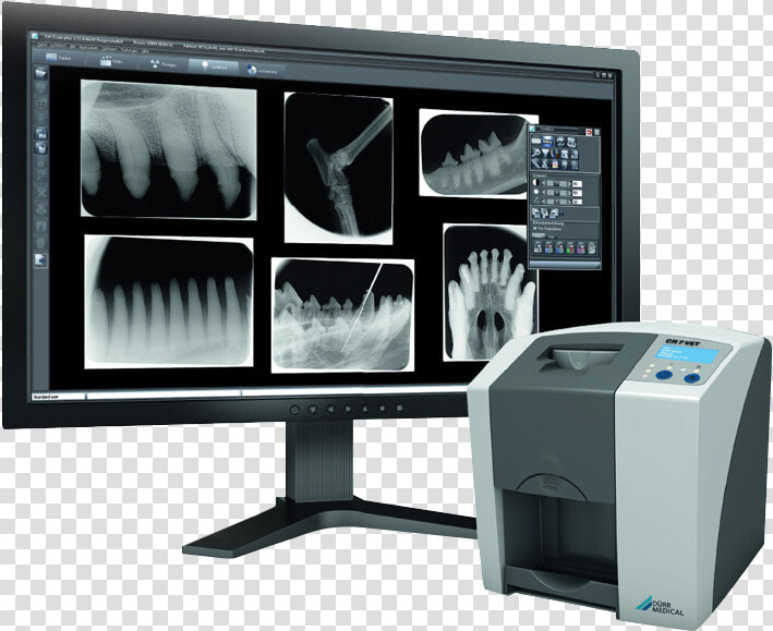 Im3 Cr7 Vet Dental Xray System   Cr7 Im3  HD Png DownloadTransparent PNG