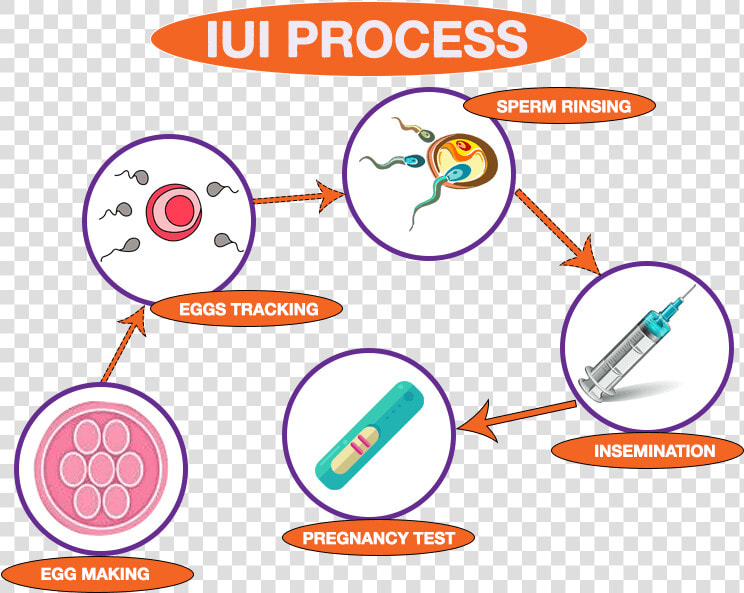 Com wp Process Png   Iui Treatment Step Step  Transparent PngTransparent PNG