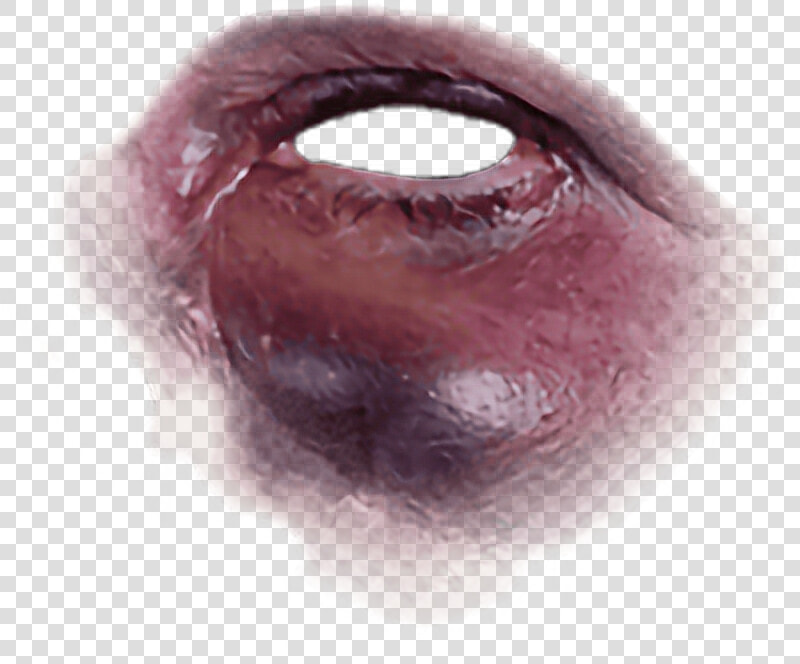 Black Eye   Bruise Black Eye Transparent  HD Png DownloadTransparent PNG