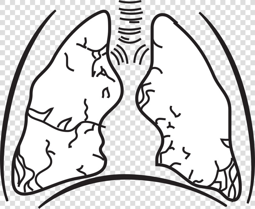 Tuberculosis Clipart Black And White  HD Png DownloadTransparent PNG