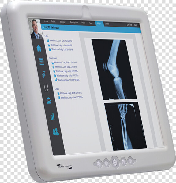 Cybermed M17s Medical Device Computer   Tablet Computer  HD Png DownloadTransparent PNG