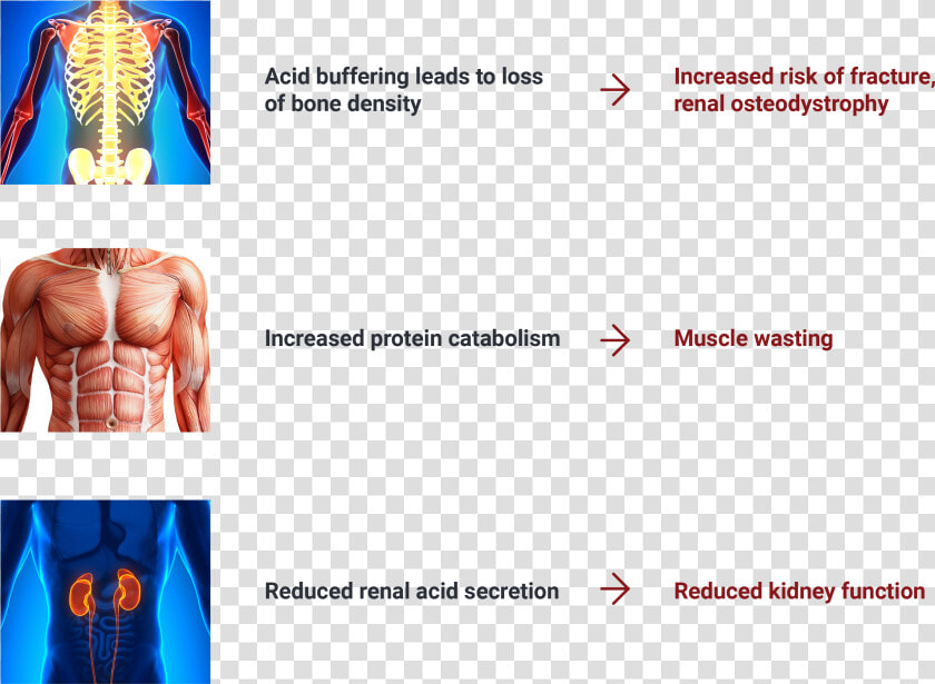 Image Depicting Serious Consequences Of Chronic Metabolic   Art  HD Png DownloadTransparent PNG