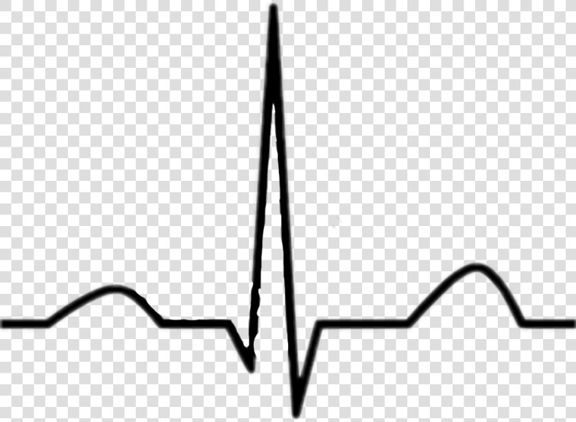  ekg  freetoedit   Electrocardiography  HD Png DownloadTransparent PNG