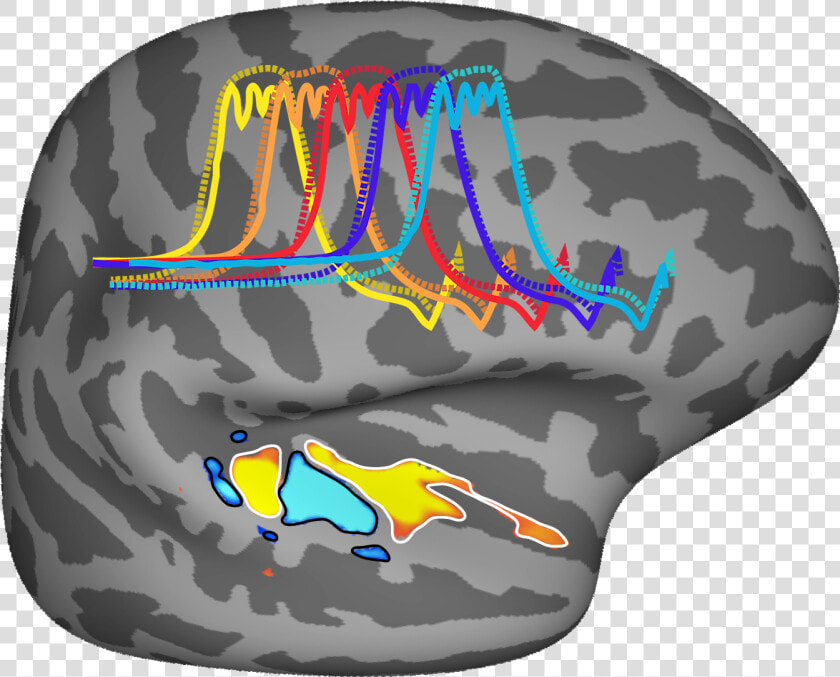 Human Brain Showing Hearing Centers   L Attivazione Della Corteccia Uditiva Nell Uomo Nella  HD Png DownloadTransparent PNG