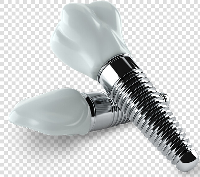 Dental Implants   Dental Implants Png  Transparent PngTransparent PNG