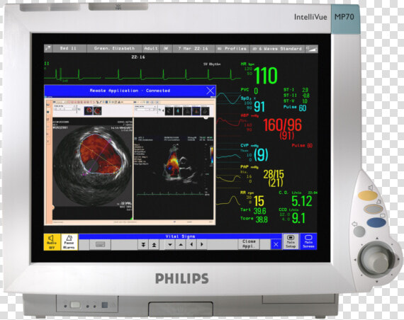 Philips Intellivue Mp70 Patient Monitor  HD Png DownloadTransparent PNG