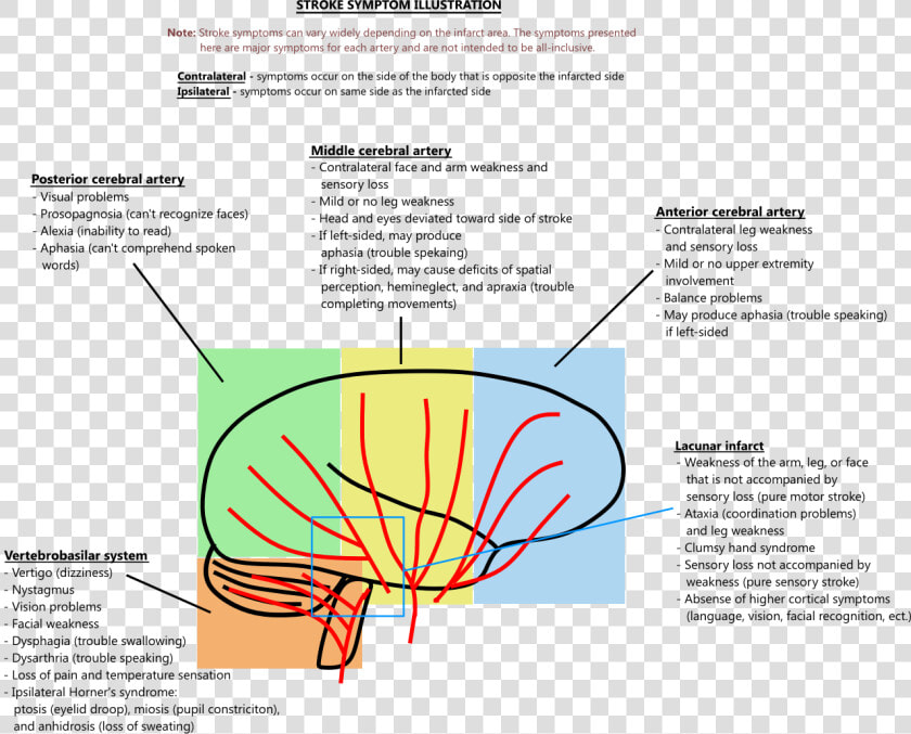 Stroke Artery Symptoms  HD Png DownloadTransparent PNG