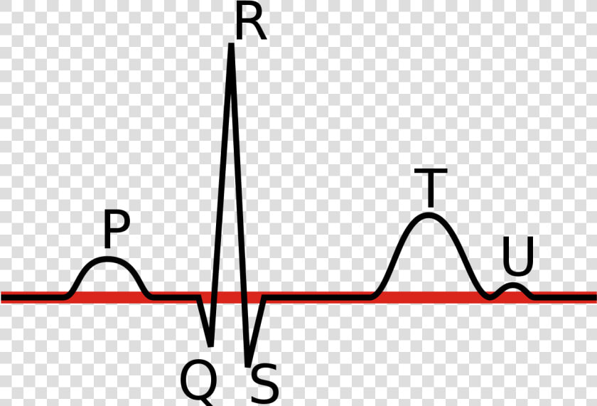 Linia Izoelektryczna Ekg   Popis Ekg  HD Png DownloadTransparent PNG