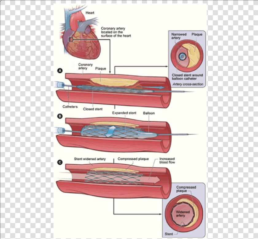 Medication Of Heart Disease  HD Png DownloadTransparent PNG