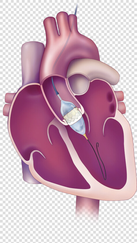 Aortic Valve  HD Png DownloadTransparent PNG