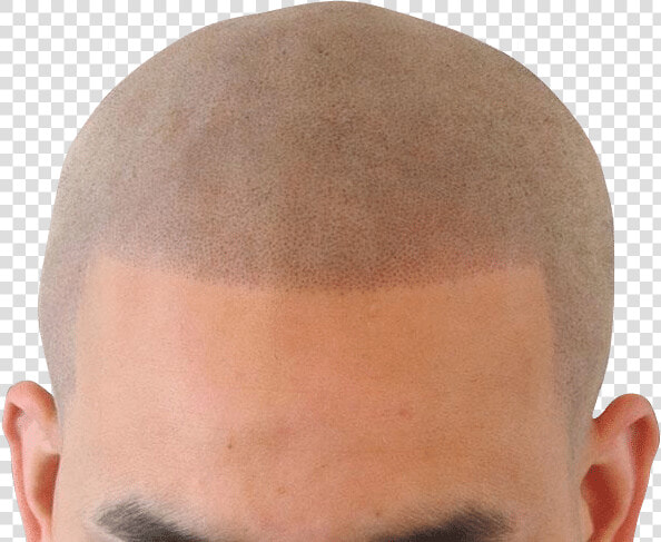 Broken Hairline   Buzz Cut  HD Png DownloadTransparent PNG