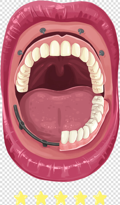 Missing Tooth  HD Png DownloadTransparent PNG